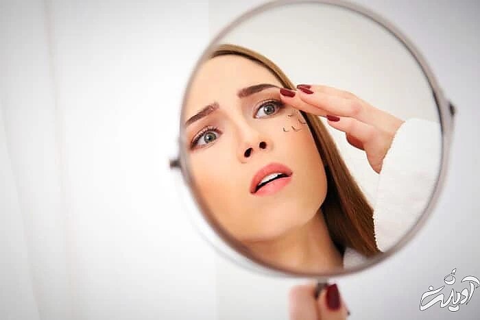 علت ریزش مژه ریزش مژه